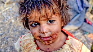 Неизмито/мръсно дете